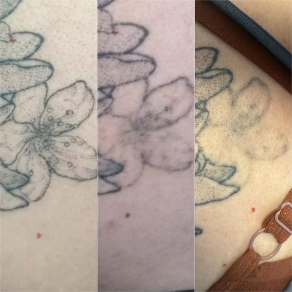 Fine line floral design tattoo by @traceless.laser