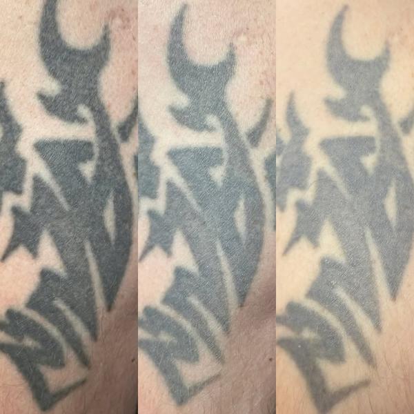 Tribal tribal design tattoo by @traceless.laser