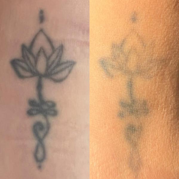 Fine line lotus flower tattoo by @traceless.laser